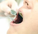歯の治療をしている人の画像